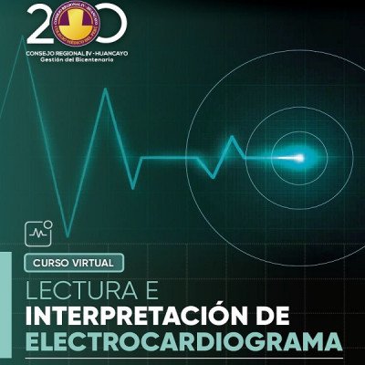 interpretación del electrocardiograma